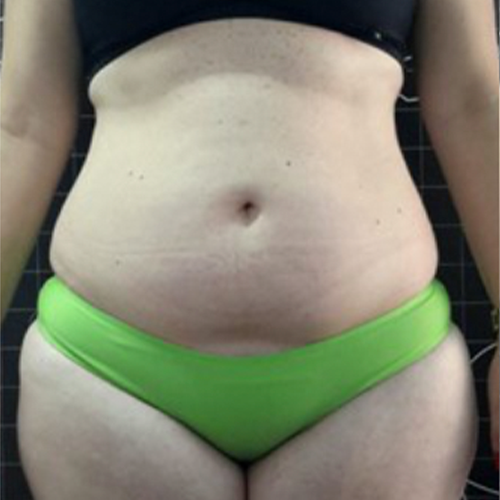 Alugue o aparelho BHS 156