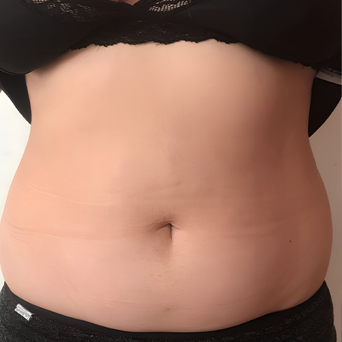 ÔNIX DUET ÔNIX DUET